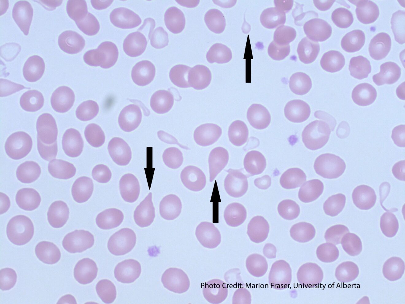 Specimen Cells Fun Quiz: Hematology Cell Identification - The Mislabeled Specimen Fun ...