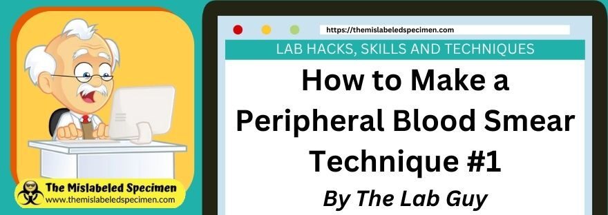 How To Properly Make A Peripheral Blood Smear Technique #1 The Mislabeled Specimen Lab Hacks, Skills and Techniques