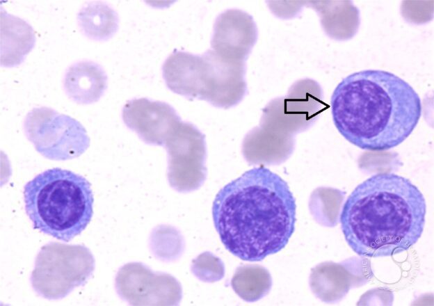 Specimen Cells Fun Quiz: Hematology Cell Identification - The Mislabeled Specimen Fun ...