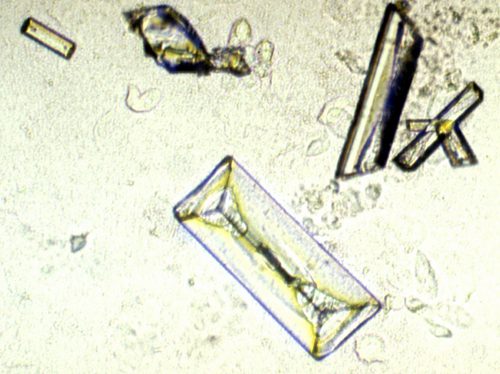 Fun Quiz: Urine Sediments - The Mislabeled Specimen