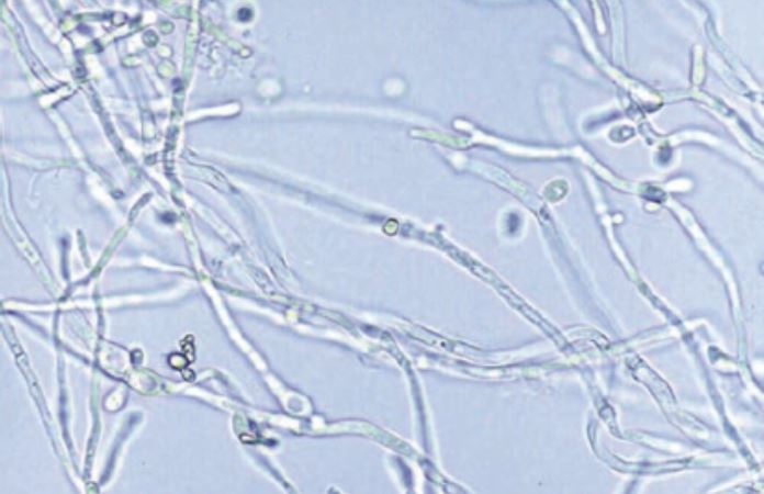 Fun Quiz Urine Sediments The Mislabeled Specimen